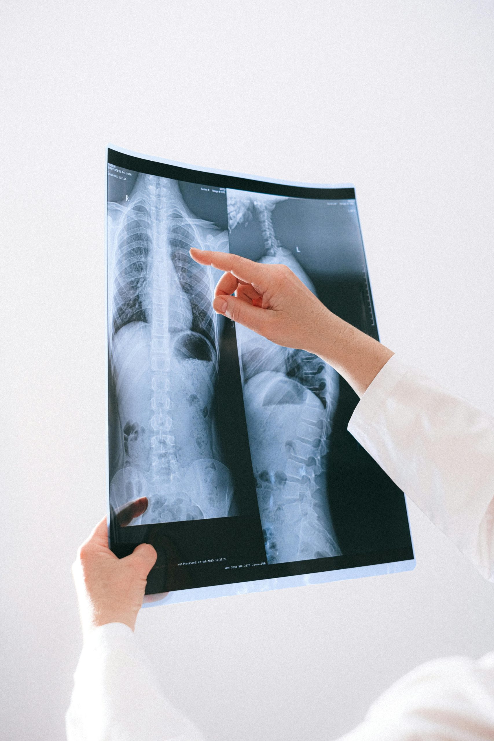Spine Surgeon In Hudson Valley